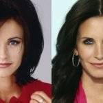 celebrity-plastic-surgery