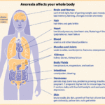 how-to-become-anorexic-using-your-diet