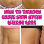 how-to-tighten-loose-skin-after-weight-loss