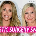 olivia-newton-john-plastic-surgery