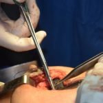 plastic-surgery